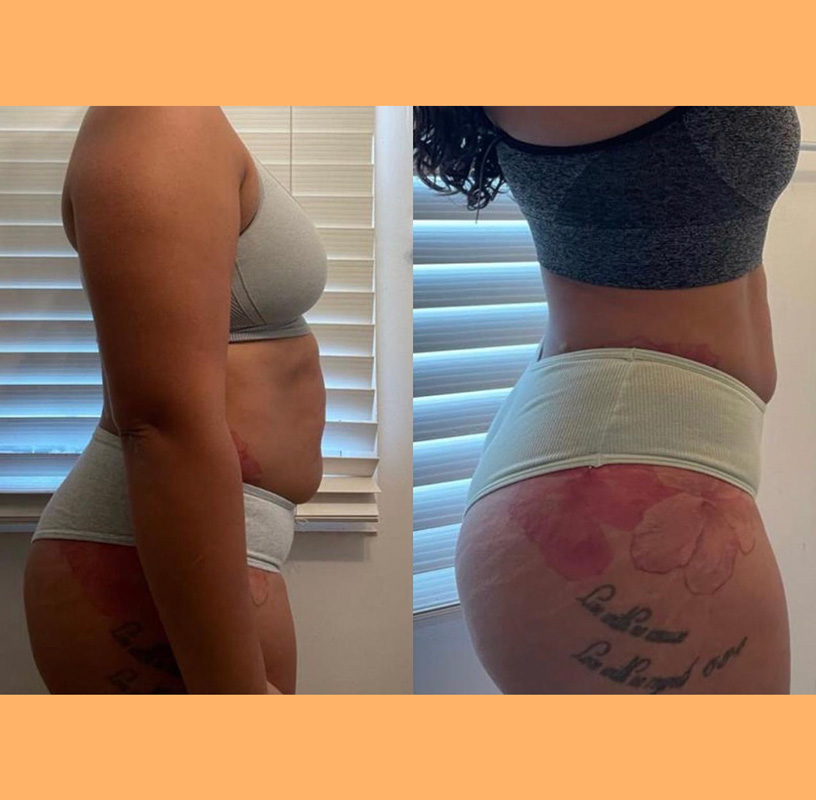 Transformation 2